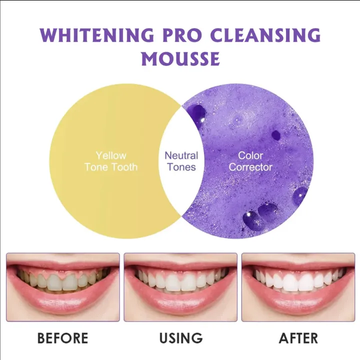 EELHOE%20DIAMOND%20GLITTER%20PRO%20WHITENING%20MOUSSE%20TOOTHPASTE%2050ML%20Professional%20Diamond%20Pro%20Whitening%20for%20Removing%20Yellow%20Teeth%20Stains%20&%20Ultra%20White%20teeth,%20immediate%20actions%20with%20guaranteed%20result%20-%20Image%206