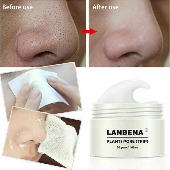 Lanbena Nose Plants Strips Mask Box - 30g