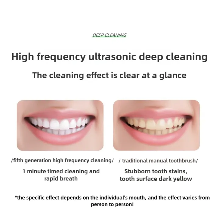 Sonic%20Electric%20Toothbrush%20Rechargeable%20%7C%20IPX7%20Waterproof%20USB%20Toothbrush%20with%204%20Dupont%20Brush%20Heads%20%7C%20Tartar%20Remover%20Portable%20Sonic%20Cleaner%20for%20Personal%20&%20Household%20Dental%20Care%20-%20A5%20-%20Image%207