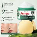 SADOER Facial Cream Acne Care Moisturizing Tea Tree Oil Acne Pimple Scar Removal Anti Acne for Face Skin Care - 50g. 