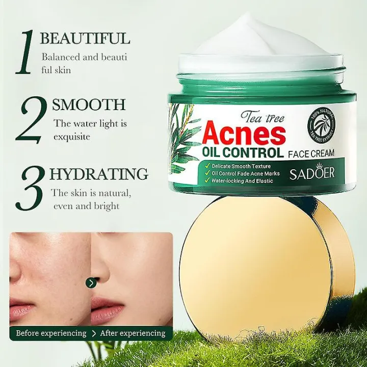 SADOER%20Facial%20Cream%20Acne%20Care%20Moisturizing%20Tea%20Tree%20Oil%20Acne%20Pimple%20Scar%20Removal%20Anti%20Acne%20for%20Face%20Skin%20Care%20-%2050g%20-%20Image%203