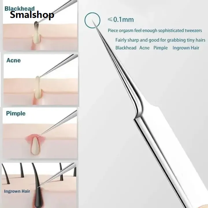 11Pcs/Set%20Acne%20Needle%20Blackhead%20Clip%20Remover%20Extraction%20Pore%20Black%20Head%20Cleaner%20Face%20Skin%20Care%20Cleansing%20Needle%20Tool%20Cell%20Clamp%20-%20Image%202
