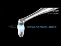 NEW Dental Light Cure Lamp Cordless LED 1S Dental Curing Light.
