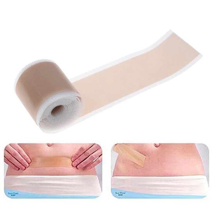 3PC%20Efficient%20Surgery%20Scar%20Removal%20Silicone%20Gel%20Sheet%20Therapy%20Patch%20for%20Acne%20Trauma%20Burn%20Scar%20Skin%20Repair%20Scar%20Treatment%20-%20Image%207