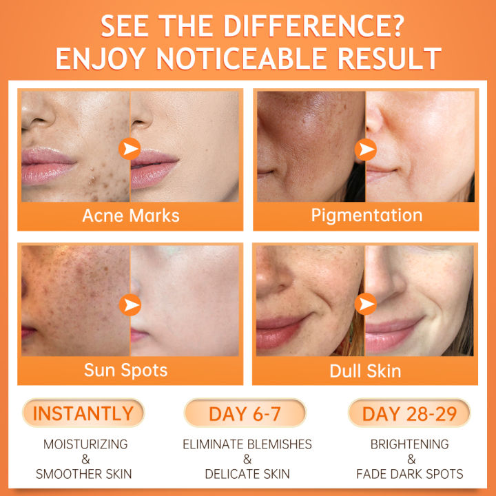 Vitamin%20C%20Whitening%20Cream%20Dark%20Spot%20Remover%20Skin%20Care%20Products%20For%20Face%20VC%20Lightening%20Black%20Skin%20Acne%20Mark%20Melanin%20Facial%20Cream%20AOutlierA%20-%20Image%203