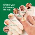 Nail Fungal Treatment Serum Anti Infection Toe Fungus Repair Liquid Cuticle Paronychia Onychomycosis Hand Foot Nail Care Essence. 