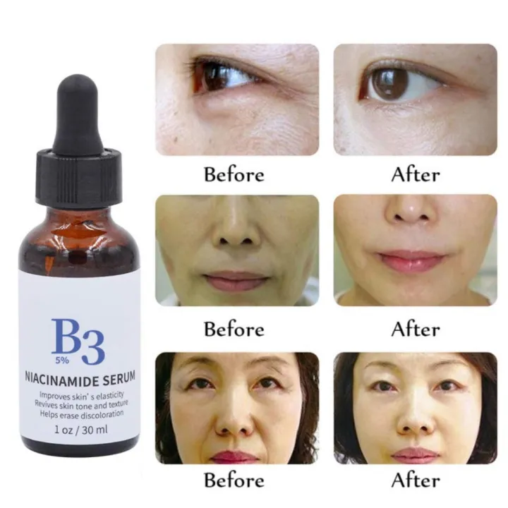 MELAO%20B3%205%25%20Niacinamide%20Serum%20-%2030ml%20-%20Image%203