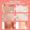Himalayan Salts Scrub Natural Pink Exfoliator For Deep Cleansing Scars Moisturizes Skin Salt Scrub Deep Cleansing Pink Himalayan.