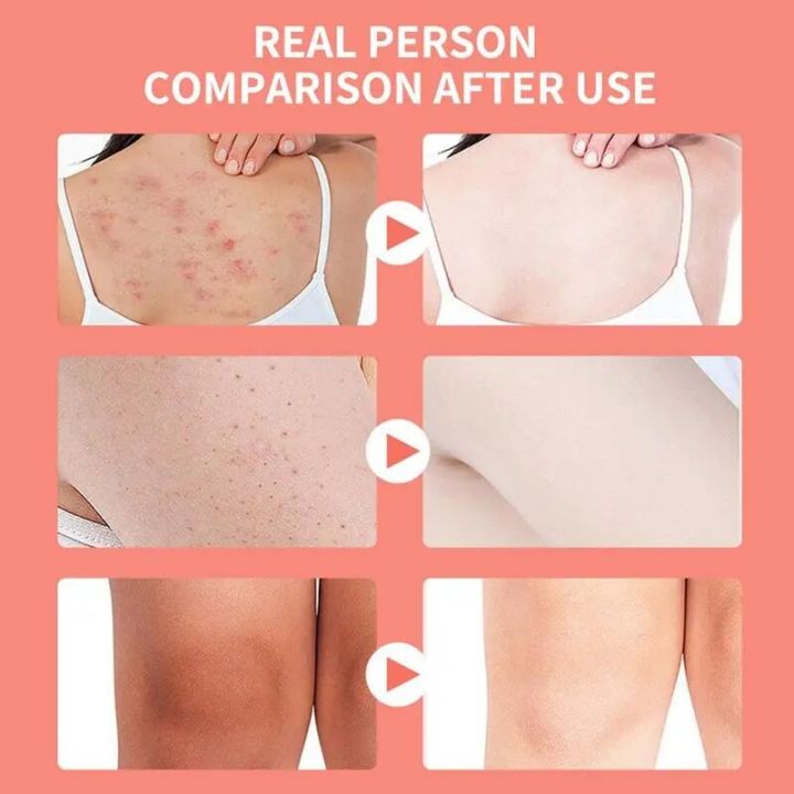 Himalayan%20Salts%20Scrub%20Natural%20Pink%20Exfoliator%20For%20Deep%20Cleansing%20Scars%20Moisturizes%20Skin%20Salt%20Scrub%20Deep%20Cleansing%20Pink%20Himalayan%20-%20Image%202