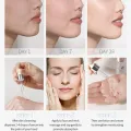 LAIKOU Switzerland Niacinamide Serum Essence 17ml. 