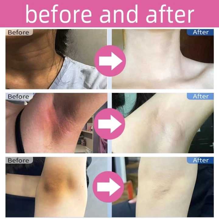 Niacinamide%20Facial%20Cleansing%20Soap%20Bar%20-%20Image%205