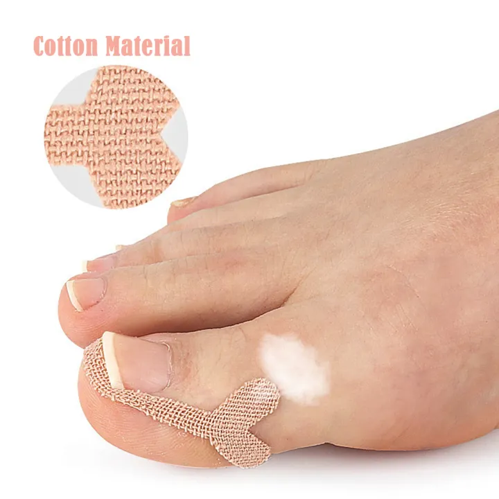8%20Pack%20Ingrown%20Toenail%20Corrector%20Sticker%20Paronychia%20Treatment%20Fixer%20Restoration%20Pedicure%20Elastic%20Sticker%20Foot%20Toe%20Nail%20Care%20Tool%20-%20Image%206