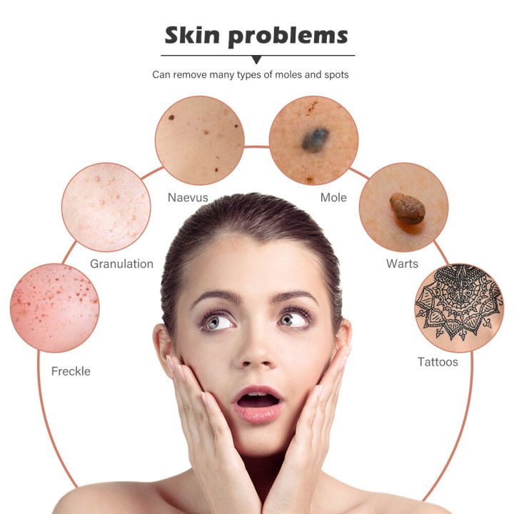LCD%20Plasma%20Removal%20Pen%20Face%20Wart%20Freckle%20Remover%20Machine%20Mole%20Dark%20Spot%20Skin%20Tag%20Removal%209%20Level%20USB%20Charge%20Beauty%20Salon%20-%20Image%205