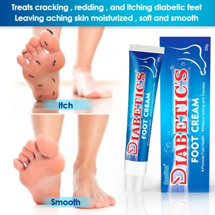 10PCs%20suifun%20diabetes%20foot%20cream%20skin%20ulcer%20ointment%20pain%20relief%20anti%20infection%20crack%20diabetic%20accessories%20Chinese%20medicine%20-%20Image%205