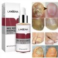 LANBENA Nail Repair Essence - 15ml. 