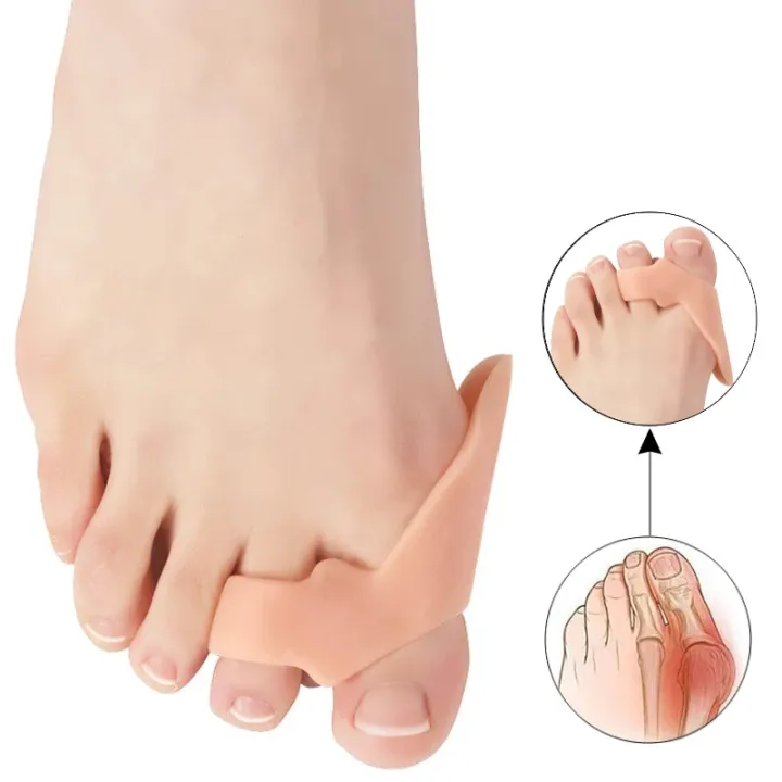 10Pairs%20Gel%20Hammer%20Toe%20Splitter%20Separators%20Silicone%20Overlapping%20Feet%20Care%20Hallux%20Valgus%20Orthopedic%20Bunion%20Corrector%20Protetor%20-%20Image%202