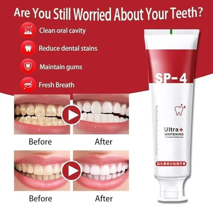 SP%204%20probiotic%20whitening%20toothpaste,%20Ultra%20Brightening%20Toothpaste,%20Advanced%20Whitening%20Formula%20for%20Stain%20Removal%20and%20Enamel%20Protection%20-%20Image%204
