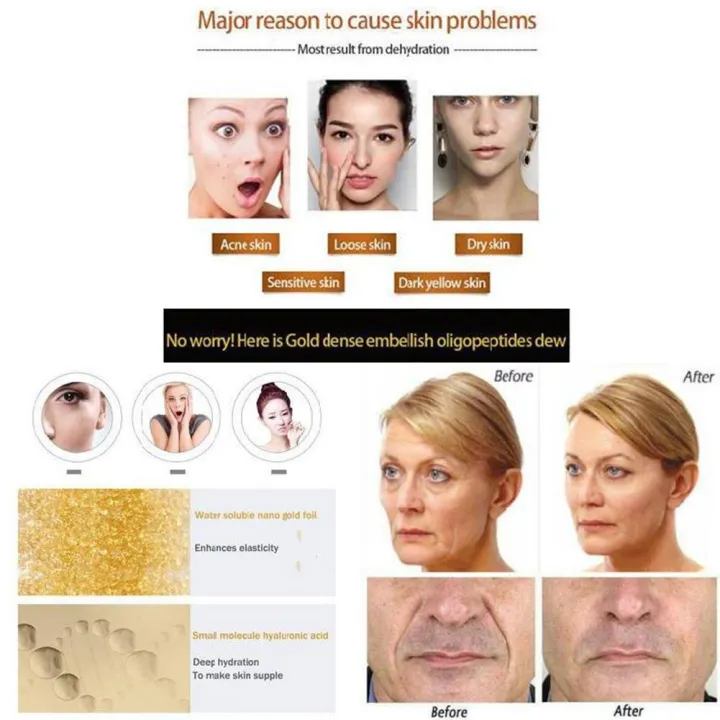 1PC%2024K%20Gold%20Face%20Cream%20Firming%20Face%20Cream%20Lifting%20Neck%20Anti-Aging%20Remove%20Wrinkles%20Night%20Day%20Moisturizer%2050/30/20g%20Oil%20Contral%20-%20Image%206