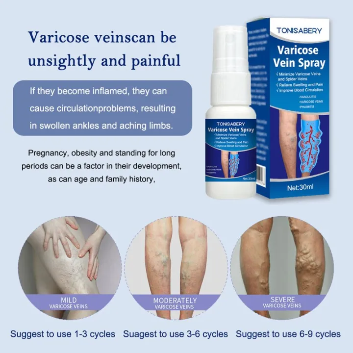 %E3%80%90Special%20offer%E3%80%91%20Varicose%20Vein%20Treatment%20Spray%20Vasculitis%20Phlebitis%20Spider%20Relief%20Fatigue%20Leg%20Dilation%20Pain%20Herbal%20Beauty%20Body%20Skin%20Care%2030ml%20-%20Image%205