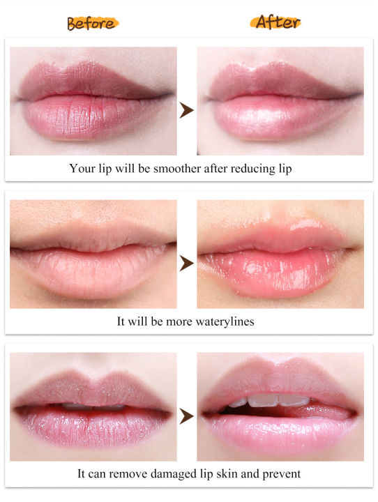 Prevent%20Dry%20Lip%20Line%20Mouth%20Mask%20Natural%20Botanical%20Vaseline%20Lip%20Balm%20Moisturizing%20Lip%20Oil%20Anti-Cracked%20Red%20Lip%20Care%20-%20Image%203