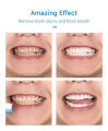 60ml Teeth Whitening Mousse Remove Stains Teeth Clean White Teeth Oral Toothpaste.
