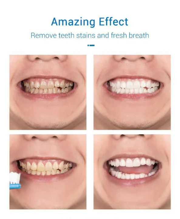 60ml%20Teeth%20Whitening%20Mousse%20Remove%20Stains%20Teeth%20Clean%20White%20Teeth%20Oral%20Toothpaste%20-%20Image%203