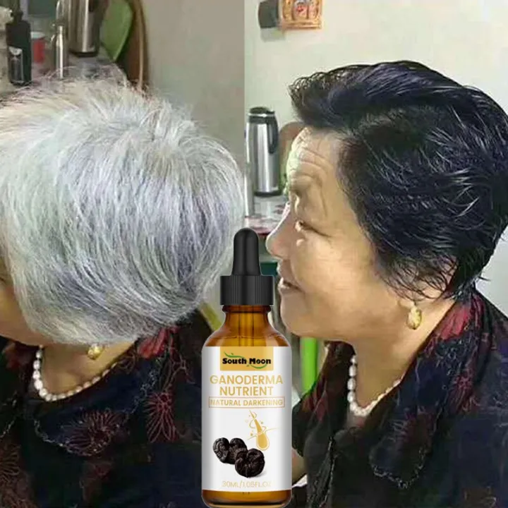 10PCS%20Gray%20White%20Hair%20Treatment%20Serum%20Liquid%20White%20To%20Black%20Natural%20Color%20Repair%20Nourish%20Product%20Anti%20Loss%20Hair%20Care%20Men%20Women%20-%20Image%203