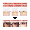 Niacinamida Whitening Face Serum Freckles Dark Spot Remover Salicylic Acid Pore Shrink Moisturizing Korean Skin Care Product30ml. 