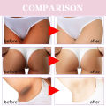 Body Whitening Cream Facial Legs Bikini Sensitive Areas Whitening Brighten Skin Colour Dark Spot Corrector For Intimate Areas. 