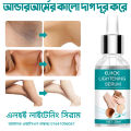 EELHOE Dark Underarm Brightener Professional Quality Korean Skin Darkness Remover. 