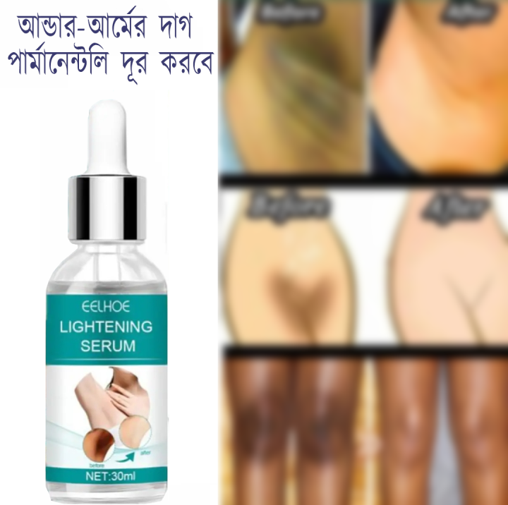 EELHOE%20Body%20And%20Private%20Parts%20Tone%20Improvement%20Serum%20For%20Men%20And%20Women%20-%20Image%202