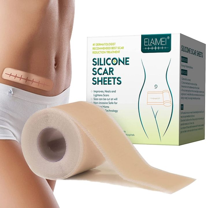 %E3%80%90Sleek%E3%80%91%20Scar%20Sheets%20Patch%20Painless%20Scar%20Repair%20Tape%20Roll%20Effective%20Scar%20Removal%20Strips%20For%20C-Section%20Keloid%20Surgery%20Burn%20Acne%20-%20Image%202