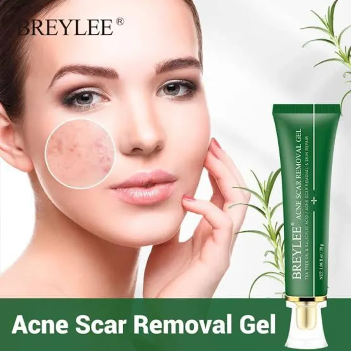 Breylee%20Acne%20&%20Scar%20Removal%20Gel%20-%2030g%20-%20Image%203