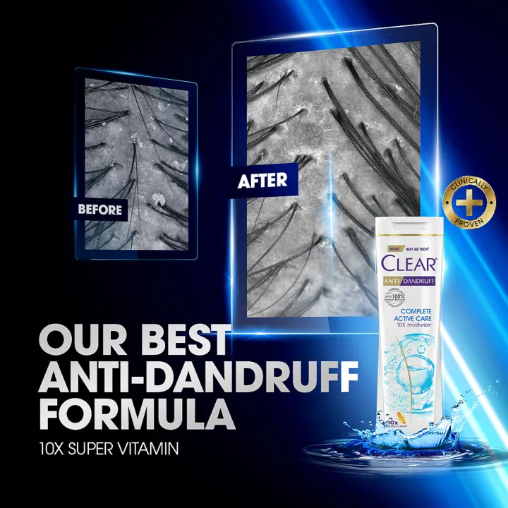 Clear%20Shampoo%20Complete%20Active%20Care%20Anti%20Dandruff%20170ml%20-%20Image%205