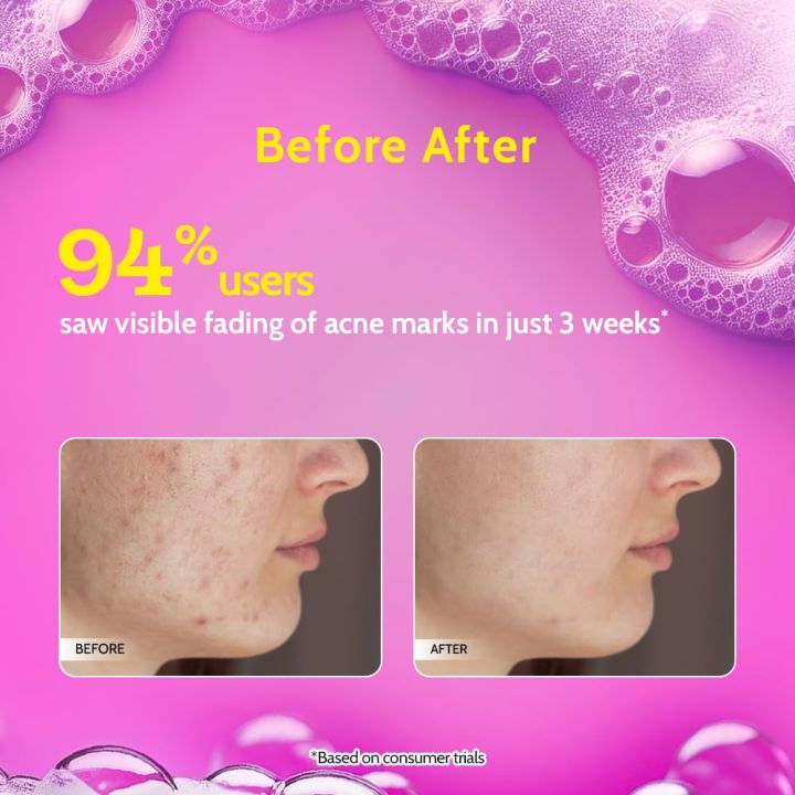 Chemist%20at%20Play%202%25%20Salicylic%20Acid%20Face%20Wash%20For%20Oily%20Skin%20with%20Niacinamide-100%20ml%20(seal%20open%20box)%20-%20Image%203