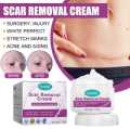 Scar Removal Cream Repairing Damaged Skin Reducing Scars And Smoothing The Skin 50g, কাটা ও পুড়ে যাওয়ার দাগ স্কিন থেকে মুছে ফেলুন। মুখমন্ডল, হাত, পা, বডি অথবা স্কিনের যেকোনো যায়গাতে ব্যবহার করতে পারবেন, #lazbinstore. 