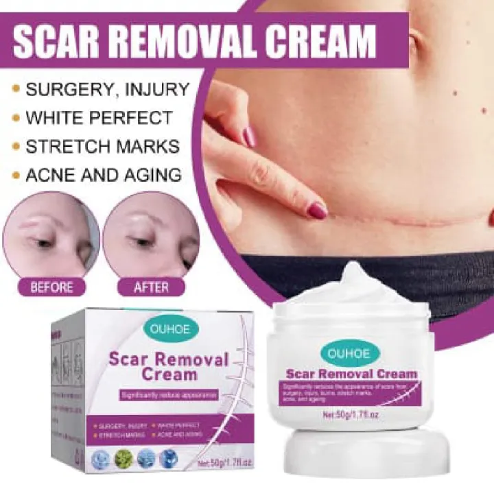 Scar%20Removal%20Cream%20Repairing%20Damaged%20Skin%20Reducing%20Scars%20And%20Smoothing%20The%20Skin%2050g,%20%E0%A6%95%E0%A6%BE%E0%A6%9F%E0%A6%BE%20%E0%A6%93%20%E0%A6%AA%E0%A7%81%E0%A7%9C%E0%A7%87%20%E0%A6%AF%E0%A6%BE%E0%A6%93%E0%A7%9F%E0%A6%BE%E0%A6%B0%20%E0%A6%A6%E0%A6%BE%E0%A6%97%20%E0%A6%B8%E0%A7%8D%E0%A6%95%E0%A6%BF%E0%A6%A8%20%E0%A6%A5%E0%A7%87%E0%A6%95%E0%A7%87%20%E0%A6%AE%E0%A7%81%E0%A6%9B%E0%A7%87%20%E0%A6%AB%E0%A7%87%E0%A6%B2%E0%A7%81%E0%A6%A8%E0%A5%A4%20%E0%A6%AE%E0%A7%81%E0%A6%96%E0%A6%AE%E0%A6%A8%E0%A7%8D%E0%A6%A1%E0%A6%B2,%20%E0%A6%B9%E0%A6%BE%E0%A6%A4,%20%E0%A6%AA%E0%A6%BE,%20%E0%A6%AC%E0%A6%A1%E0%A6%BF%20%E0%A6%85%E0%A6%A5%E0%A6%AC%E0%A6%BE%20%E0%A6%B8%E0%A7%8D%E0%A6%95%E0%A6%BF%E0%A6%A8%E0%A7%87%E0%A6%B0%20%E0%A6%AF%E0%A7%87%E0%A6%95%E0%A7%8B%E0%A6%A8%E0%A7%8B%20%E0%A6%AF%E0%A6%BE%E0%A7%9F%E0%A6%97%E0%A6%BE%E0%A6%A4%E0%A7%87%20%E0%A6%AC%E0%A7%8D%E0%A6%AF%E0%A6%AC%E0%A6%B9%E0%A6%BE%E0%A6%B0%20%E0%A6%95%E0%A6%B0%E0%A6%A4%E0%A7%87%20%E0%A6%AA%E0%A6%BE%E0%A6%B0%E0%A6%AC%E0%A7%87%E0%A6%A8,%20#lazbinstore%20-%20Image%208