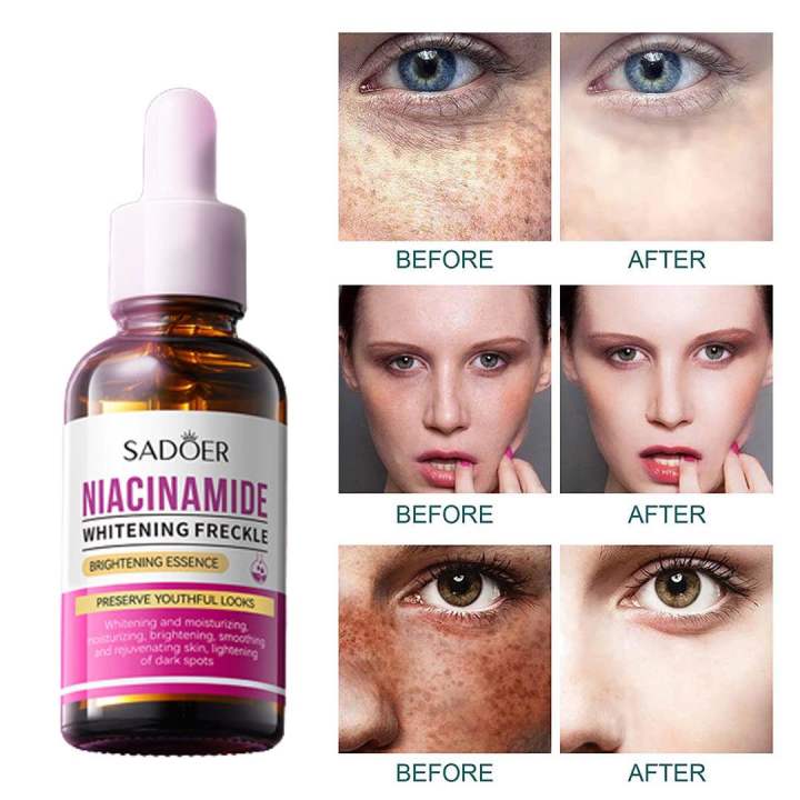 SADOER%20Niacinamide%20Skin%20Whitening%20Face%20Serum%20for%20Shrink%20Pores,%20Dark%20Spots%20and%20Freckles%20serum-30ml%20-%20Image%204