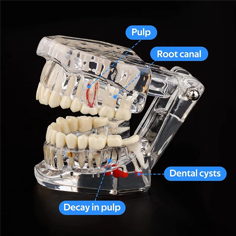 Buy Dental Model, Mandibular Tissue Decomposition Model, Doctor-Patient