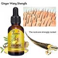 Fast Hair Growth Men Women Ginger Growth Hair Oil Treatment Anti Hair Loss Scalp Treatment Serum Products Beauty Health Lateil. 