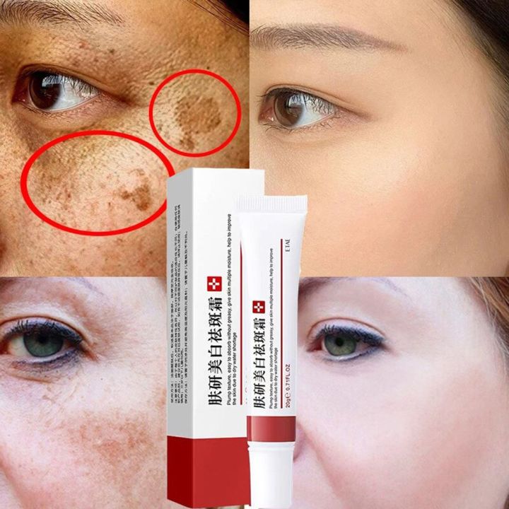 %E3%80%90The%20Edge%20of%20Beauty%E3%80%91Whitening%20freckle%20cream%20remove%20melasma%20melanin%20spots%20lightening%20cream%20-%20Image%206
