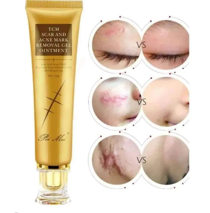 TCM%20Scar%20Acne%20Mark%20Removal%20Gel%20Ointment,%2030g%20-%20Image%202