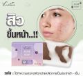 V-Nature Acne Soap for Men & Women | For Face & Body Acne | Thailand. 