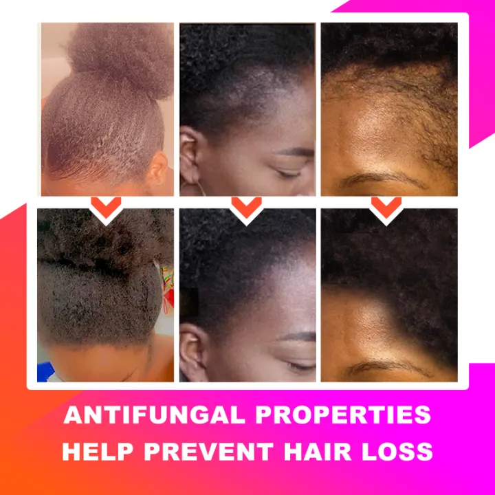 Africa%20Chad%20Chebe%20Powder%20100%25%20Natural%20Super%20Fast%20Hair%20Regrowth%20Anti%20Hair%20Break%20Local%20Ingredients%20with%20Modern%20Craftsmanship%20100g%20BruberryBeE%20-%20Image%203