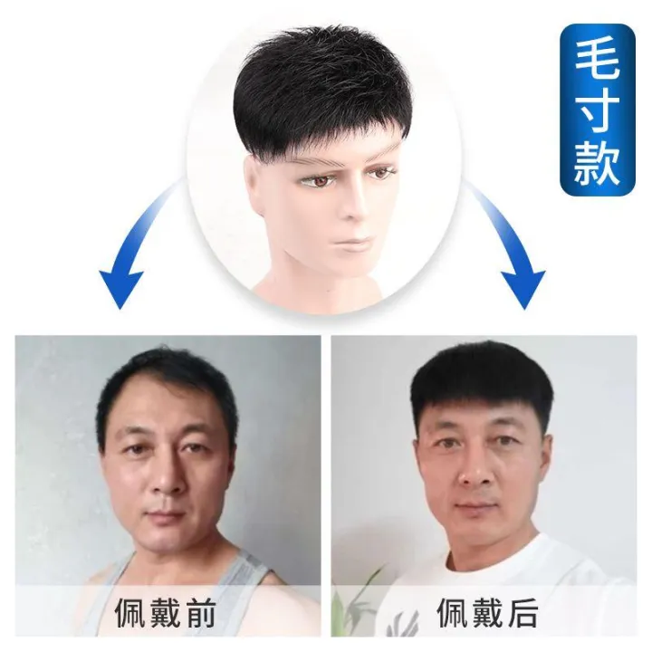 Wig%20men%20s%20short%20hair%20Korean%20version%20handsome%20head%20replacement%20hair%20weaving%20men%20s%20real%20hair%20bald%20high%20forehead%20breathable%20-%20Image%203
