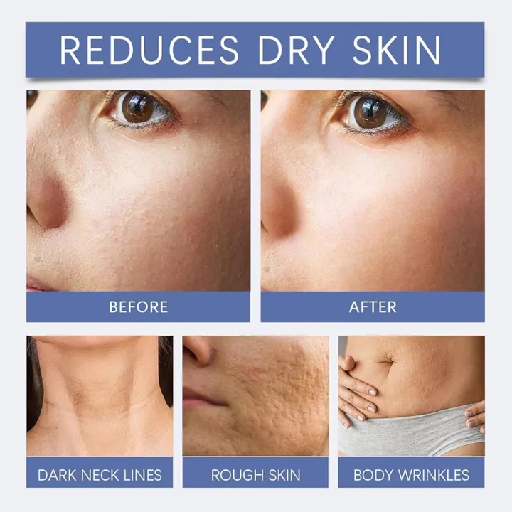TWG%20Hyaluronic%20Acid%20and%20Moisturizing%20Hand%20Care%20Cream%20and%20Serum%20essence%20-%20Image%206