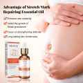 【7Rings Store】Repair Essential Oil Stretch Mark Removal Removal Acne Stretch Marks Fat Striae Gravidarum Oils 20ml.