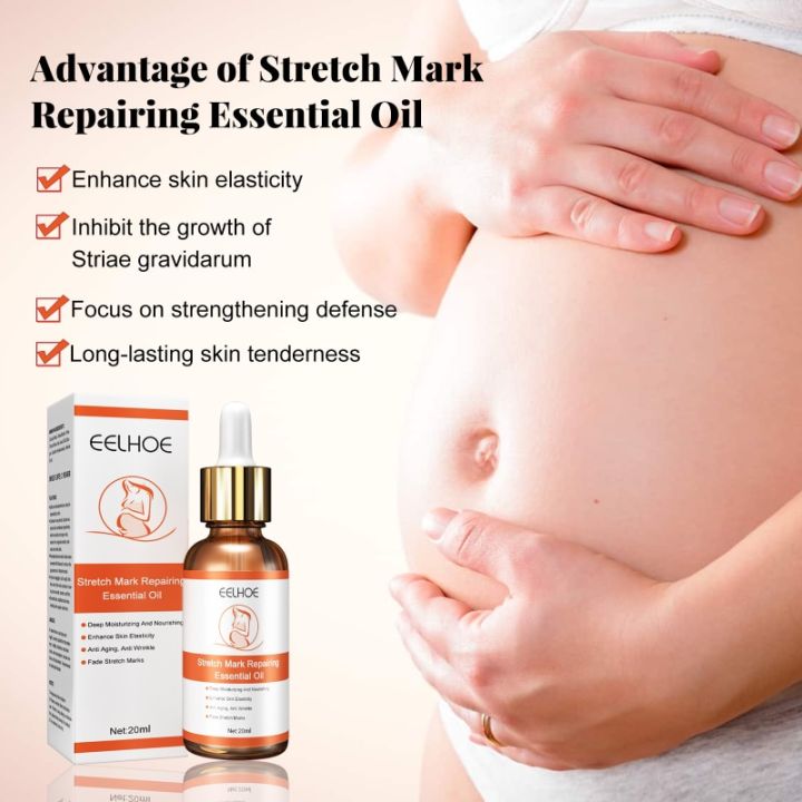 【7Rings Store】Repair Essential Oil Stretch Mark Removal Removal Acne Stretch Marks Fat Striae Gravidarum Oils 20ml