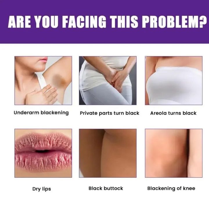 Lightening%20Cream%20Dark%20Neck%20Lightening%20Cream%20Brightens%20And%20Moisturizes%20For%20Intimate%20Areas%20Armpit%20Neck%20Back%20Legs%20Elbows%20-%20Image%203