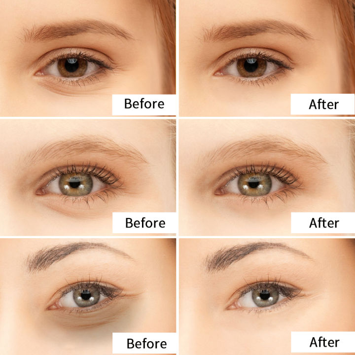 Crystal%20Collagen%2024K%20Active%20Gold%20Powder%20Eye%20Mask%20+%20IPL%20Eye%20Essence%20Importer%20Safe%20Natural%20Ingredients%20Improve%20Dark%20Circles%20Firm%20-%20Image%205